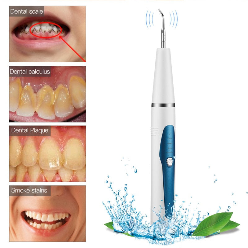 Portable Ultrasonic Dental Scaler with stainless steel cleaning head and ergonomic design for effective tooth cleaning.