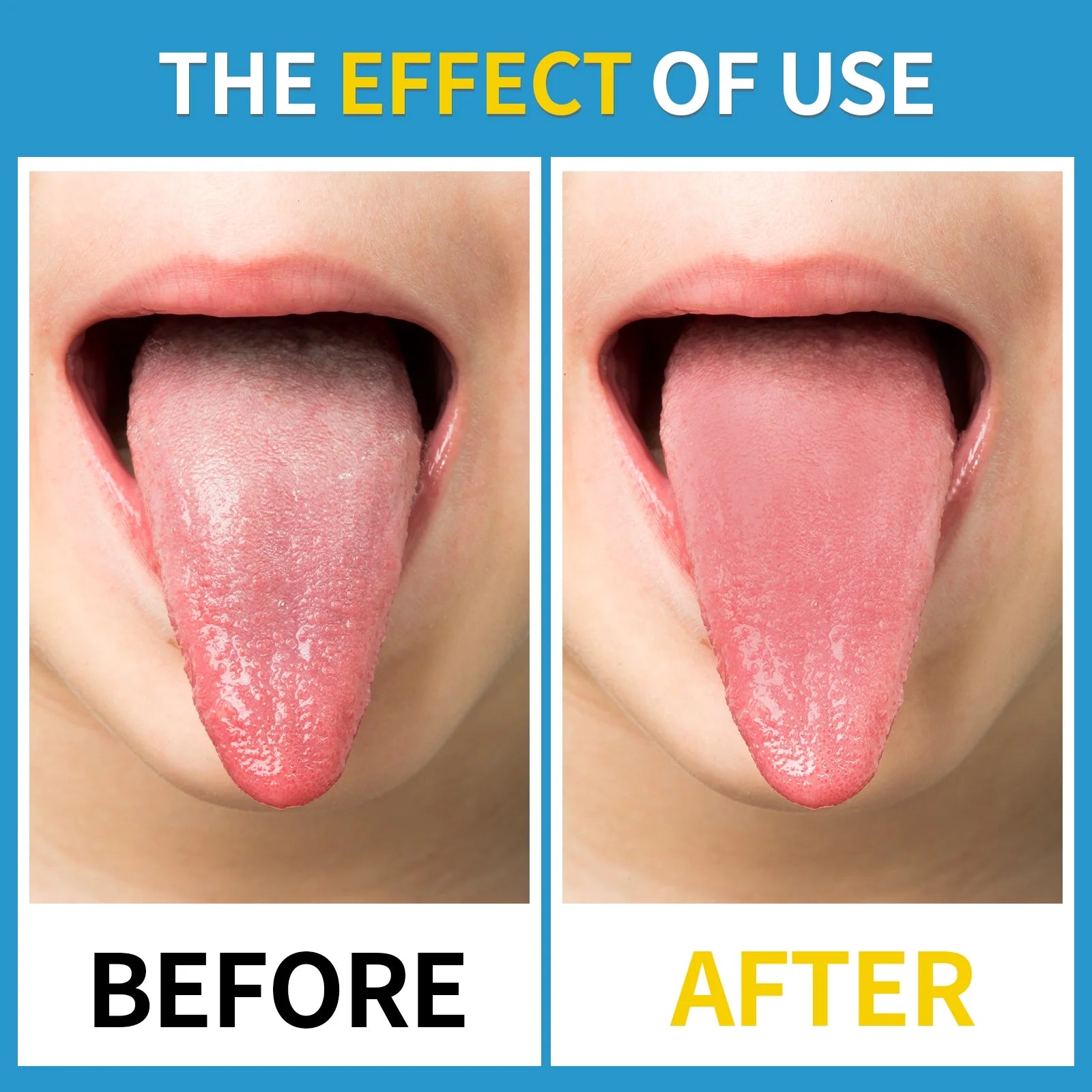 Two stainless steel tongue scrapers in a portable case, showcasing ergonomic design and eco-friendly material.