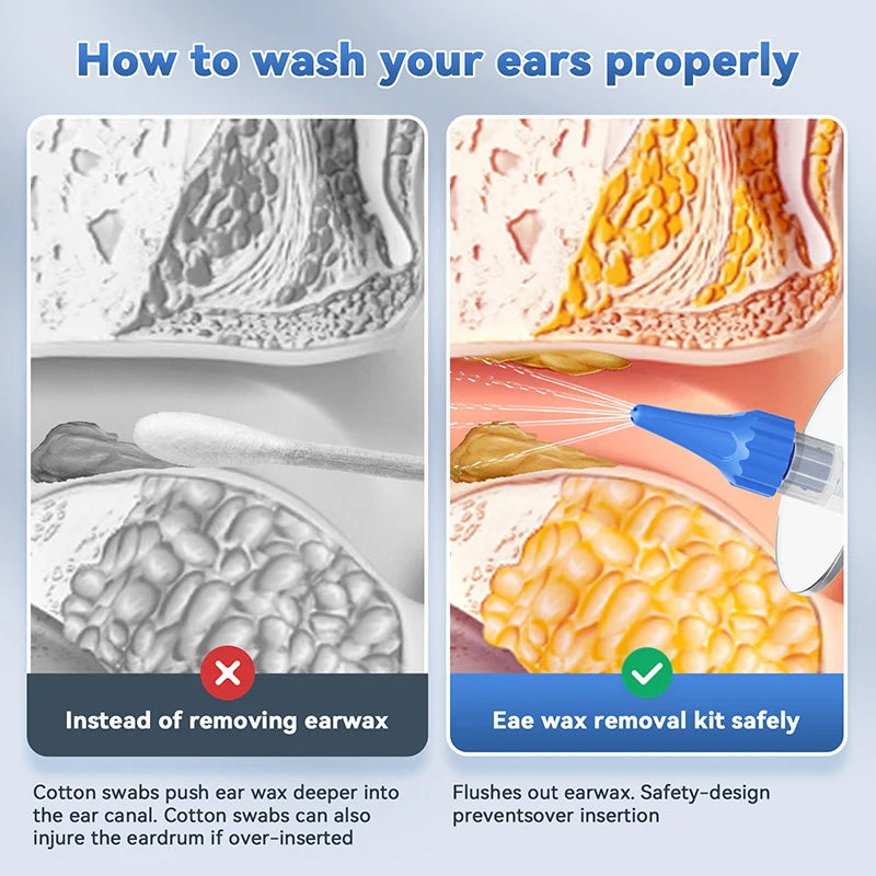 Manual ear wax removal tool with water basin and nozzles for safe ear irrigation.