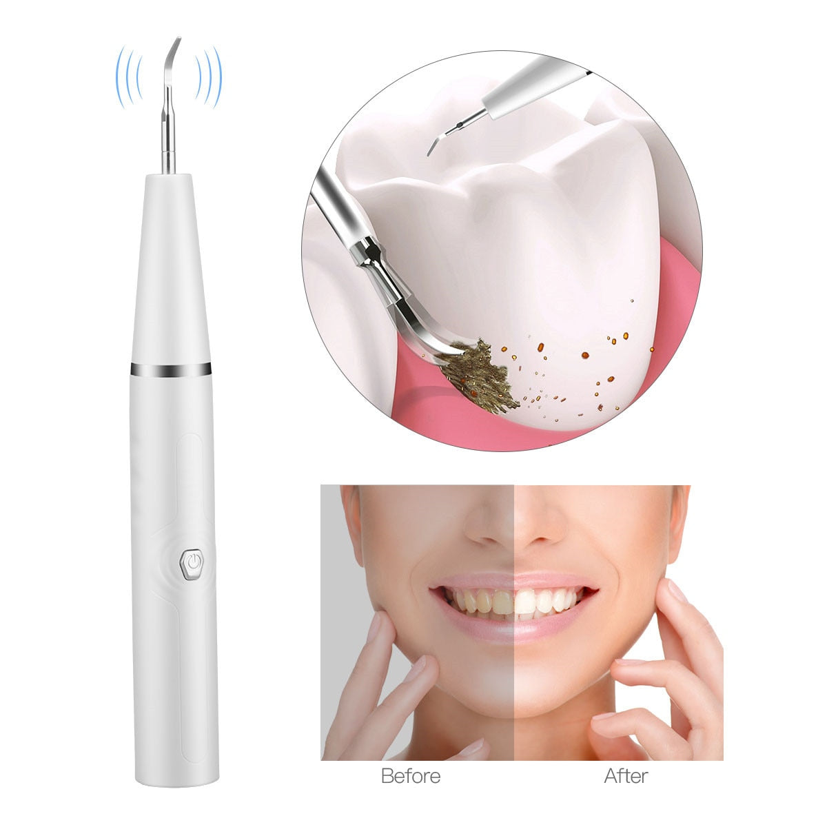 Electric Ultrasonic Sonic Dental Scaler with multiple cleaning heads and accessories, designed for effective dental hygiene.