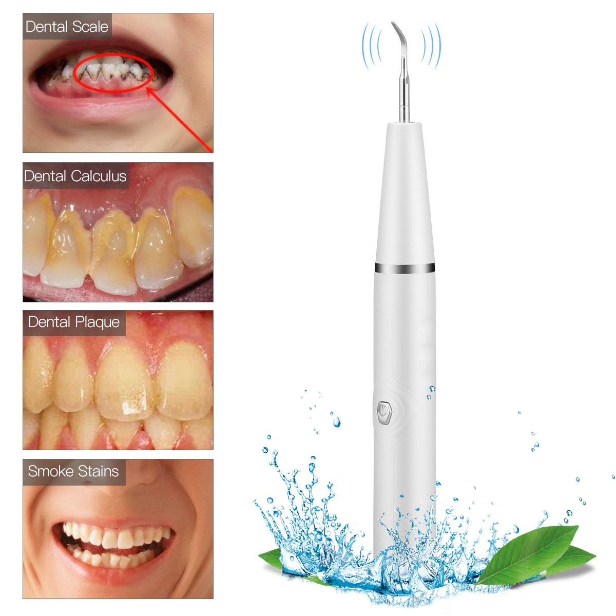 Electric Ultrasonic Sonic Dental Scaler with multiple cleaning heads and accessories, designed for effective dental hygiene.