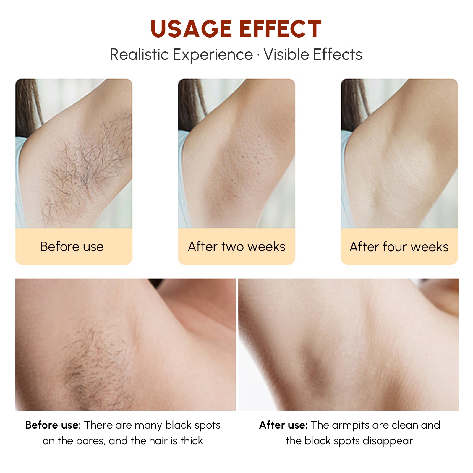 Home Laser Hair Removal Device designed for whole body use, featuring a sleek design and multiple adjustable settings for painless hair removal.