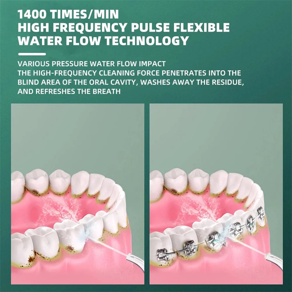 Portable USB rechargeable oral irrigator with a sleek design, featuring a large water tank and adjustable modes for effective dental cleaning.