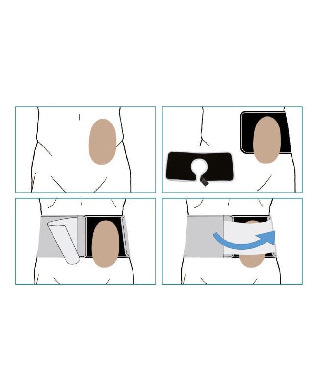 Ostomy Support Belt Orione Ref.3052, height 16 cm, designed for optimal support and comfort for ostomy bags.