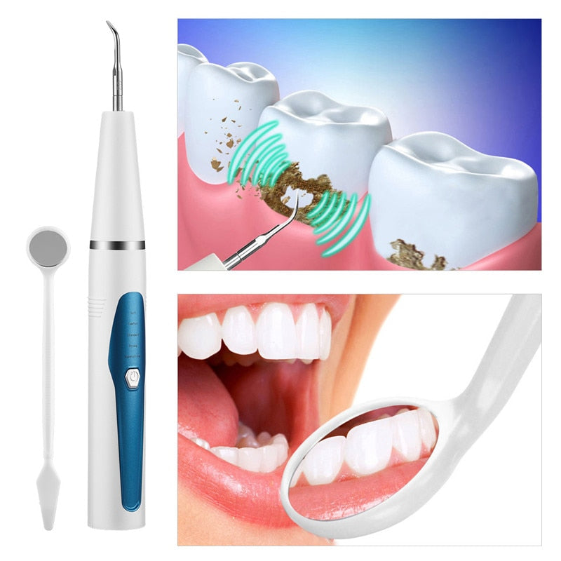 Portable Ultrasonic Dental Scaler with stainless steel cleaning head and ergonomic design for effective tooth cleaning.