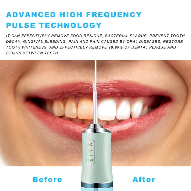 Profession Dental Water Flosser with multiple nozzles for effective teeth cleaning and whitening, showcasing its sleek design and user-friendly features.