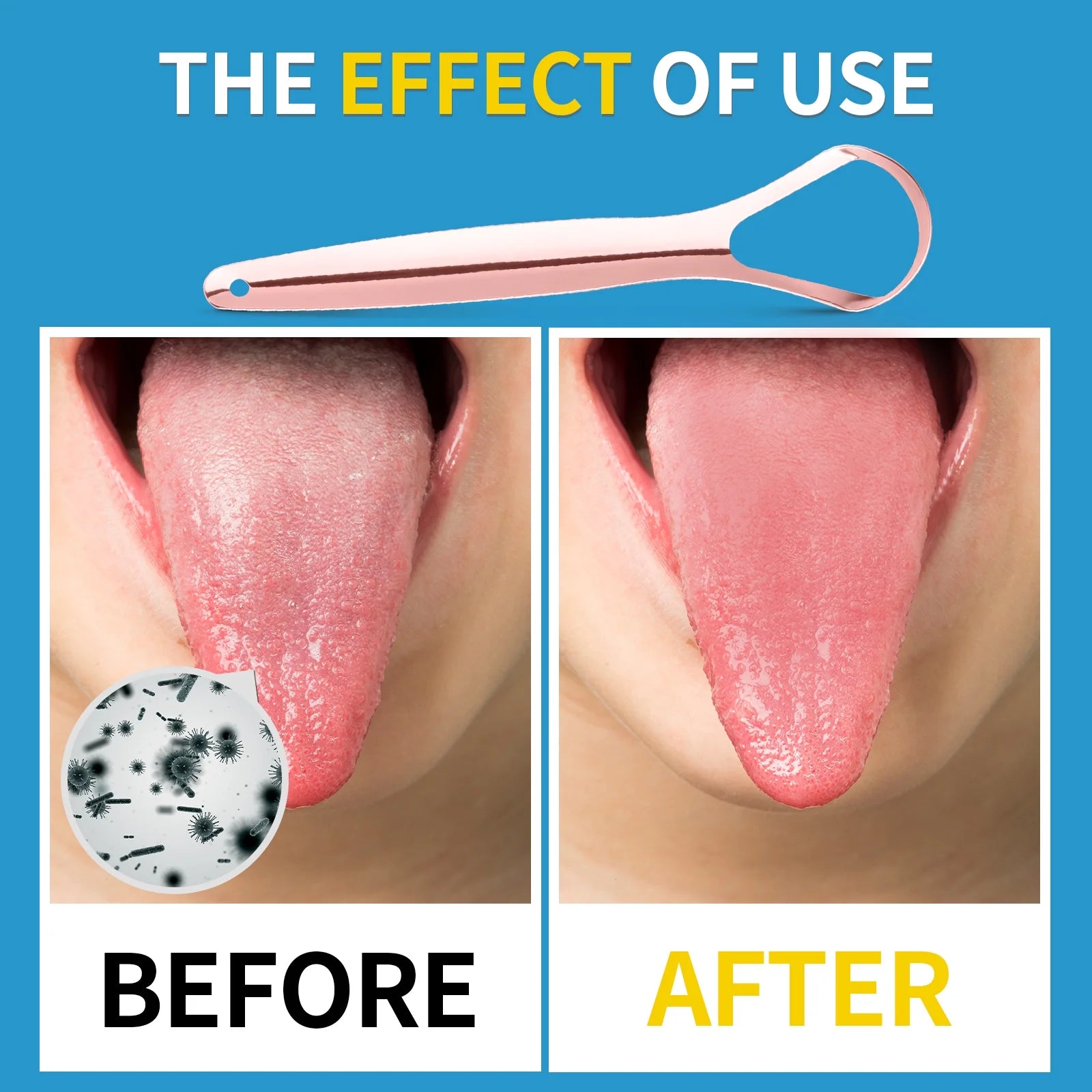 Stainless steel tongue scraper with travel case in silver and rose gold colors, designed for effective oral care and bad breath prevention.