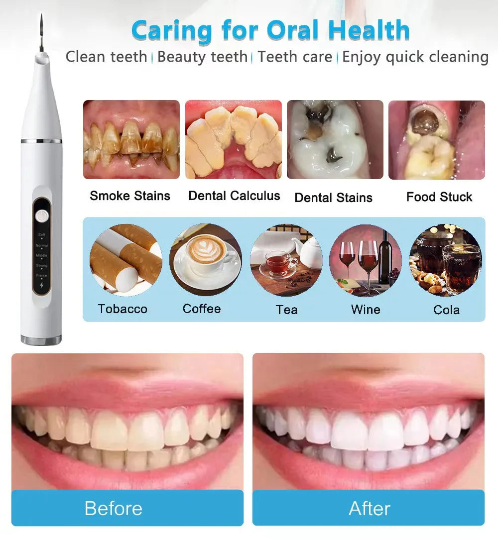 Ultrasonic Dental Scaler with various attachments for effective teeth cleaning, showcasing its sleek design and user-friendly features.