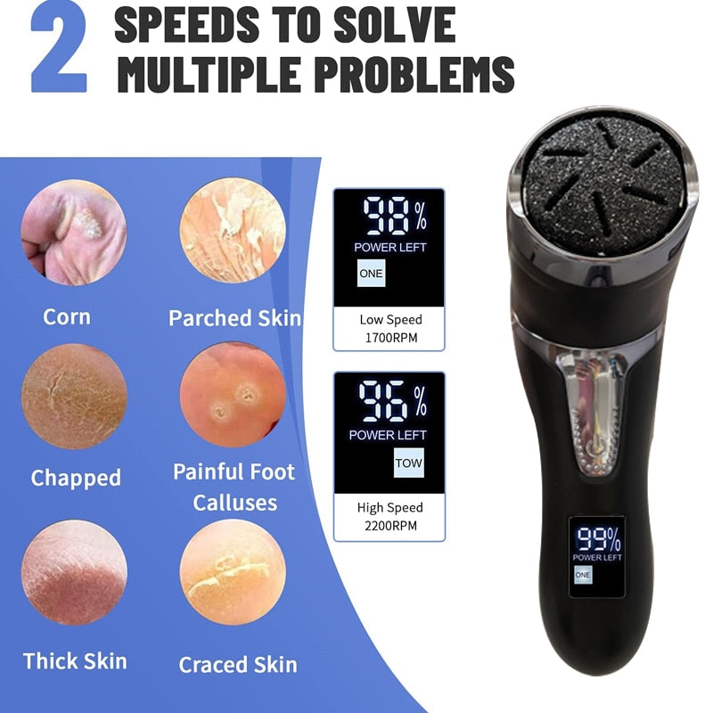 Rechargeable Electric Foot Rasp with vacuum feature, showcasing its sleek design and interchangeable roller heads for effective foot care.
