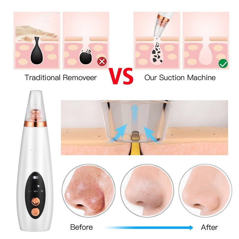 6 In 1 Electric Facial Blackhead Remover with multiple tips and USB charging cable, designed for effective skin care and acne removal.
