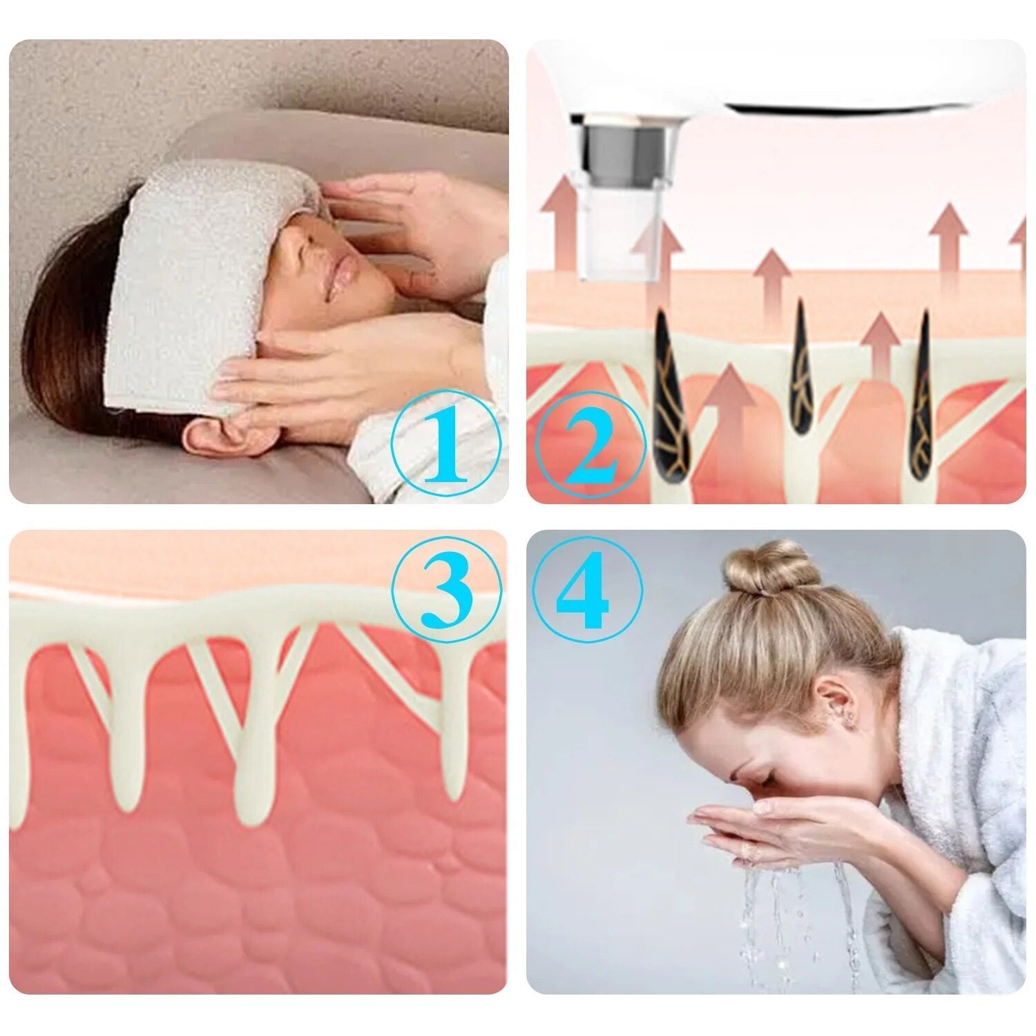 Blackhead Remover Electric Vacuum Suction device with multiple tips and USB charging cable, designed for effective blemish cleaning.