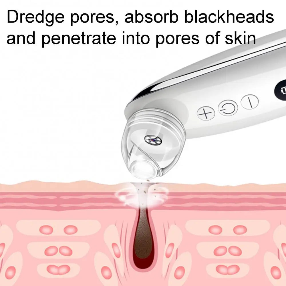 Blackhead Remover Pore Vacuum Cleaner with multiple suction heads and USB charging cable, designed for effective skin care.
