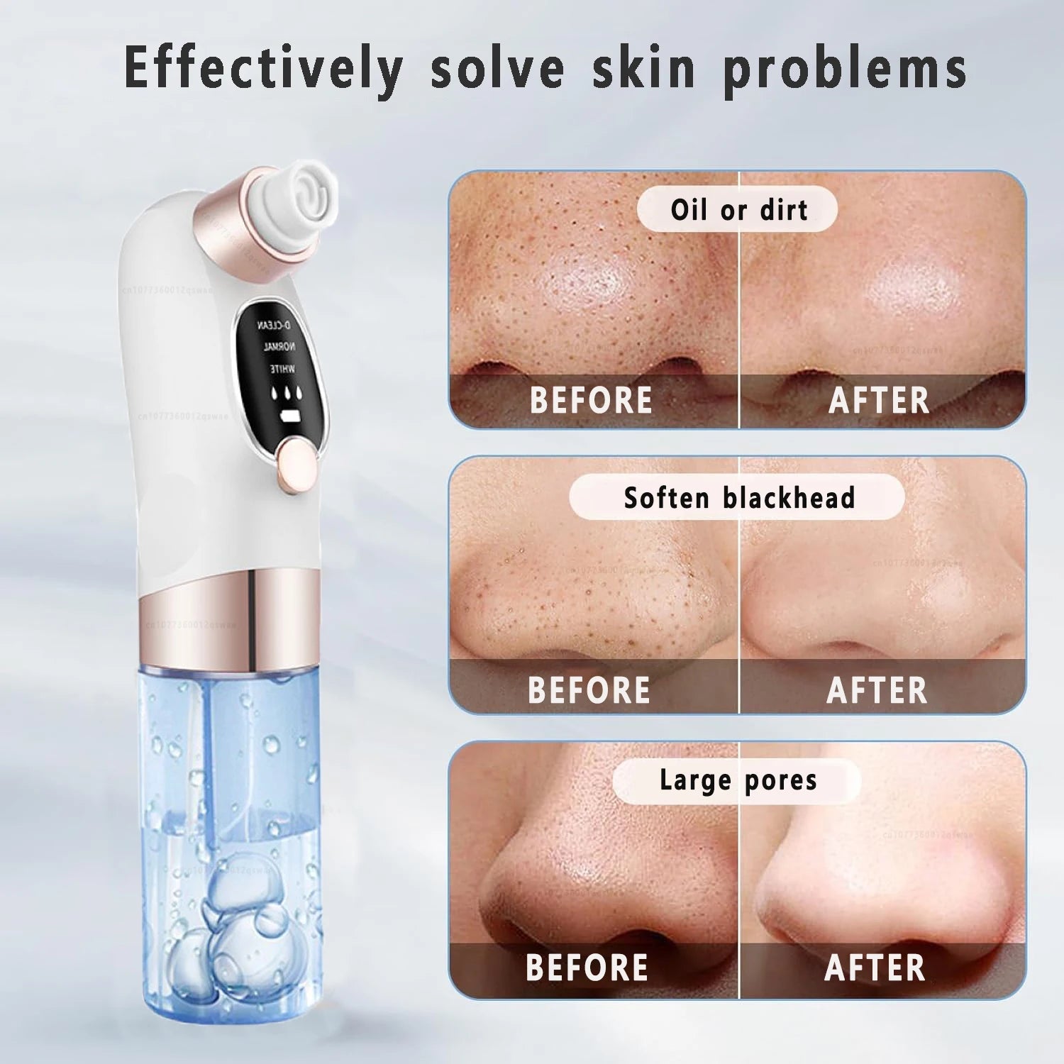 Blackhead Remover Pore Vacuum device with multiple suction heads and USB charging port, designed for deep facial cleansing.