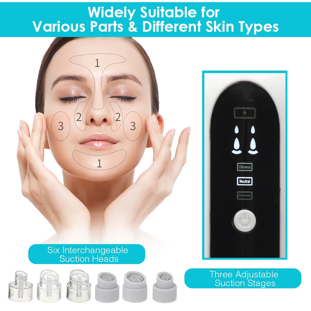 Blackhead Remover Vacuum Suction device with USB charging, featuring multiple suction heads for effective skincare.