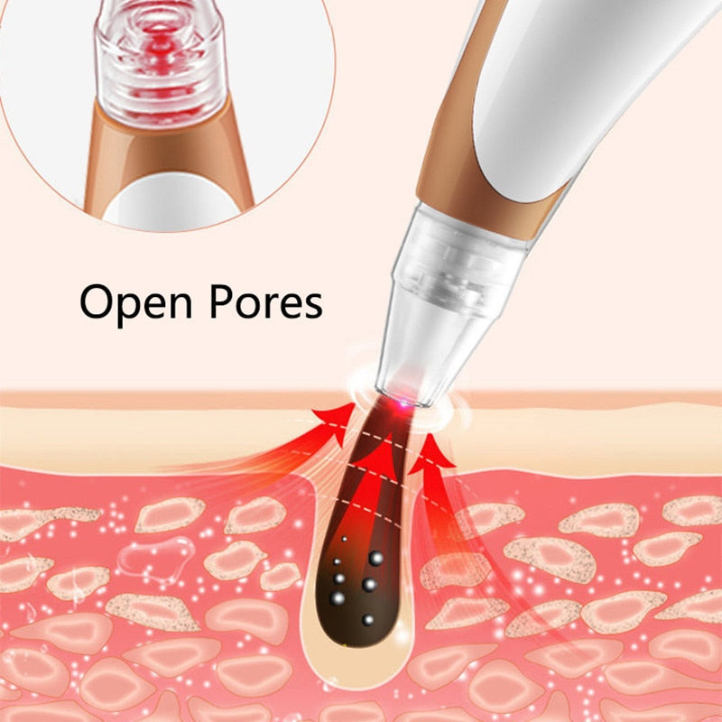 Electric Blackhead Remover with multiple suction tips and beauty lamp for effective skin care.