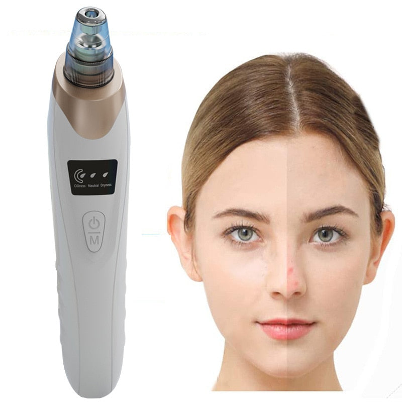 Electric Facial Blackhead Remover Vacuum with multiple replacement heads and USB charging cable, designed for effective acne and blackhead removal.