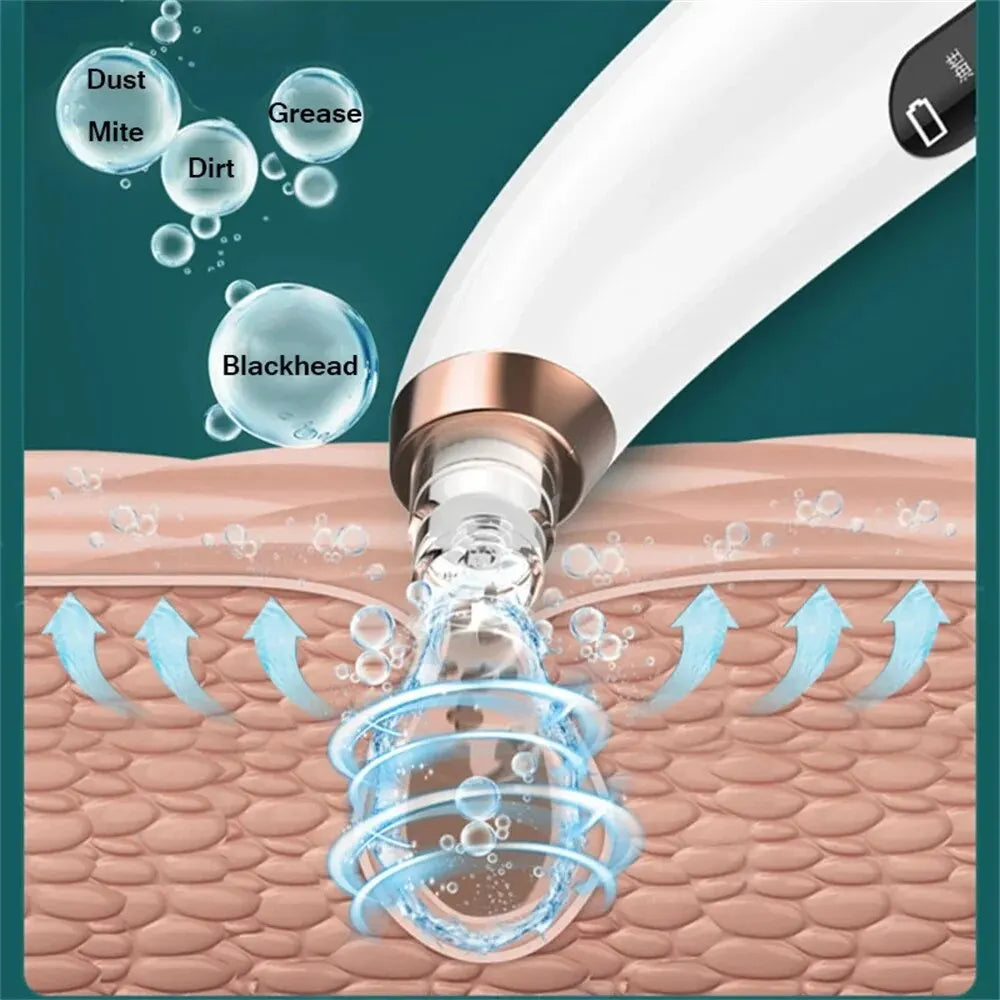 Electric Small Bubble Blackhead Remover with ergonomic design and USB charging feature, showcasing interchangeable heads for versatile skincare.