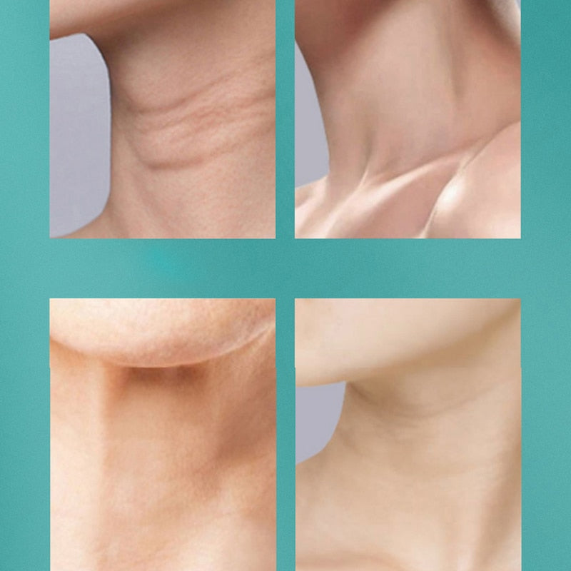 EMS Neck Massager in three colors with LED lights, designed for anti-wrinkle treatment and skin rejuvenation.