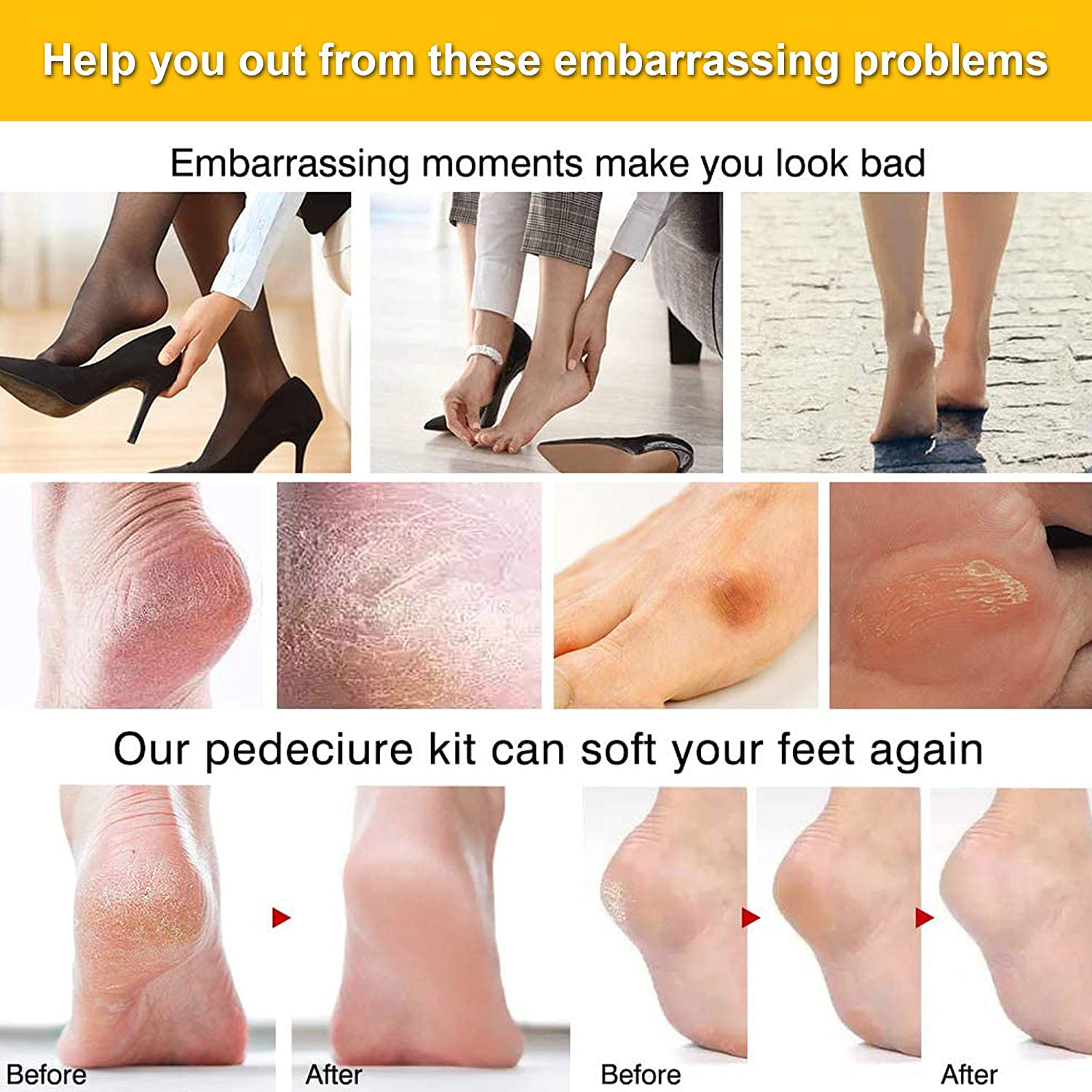 23 in 1 Foot Care Set featuring stainless steel tools for pedicure and foot care, including nail clippers, callus removers, and foot files.