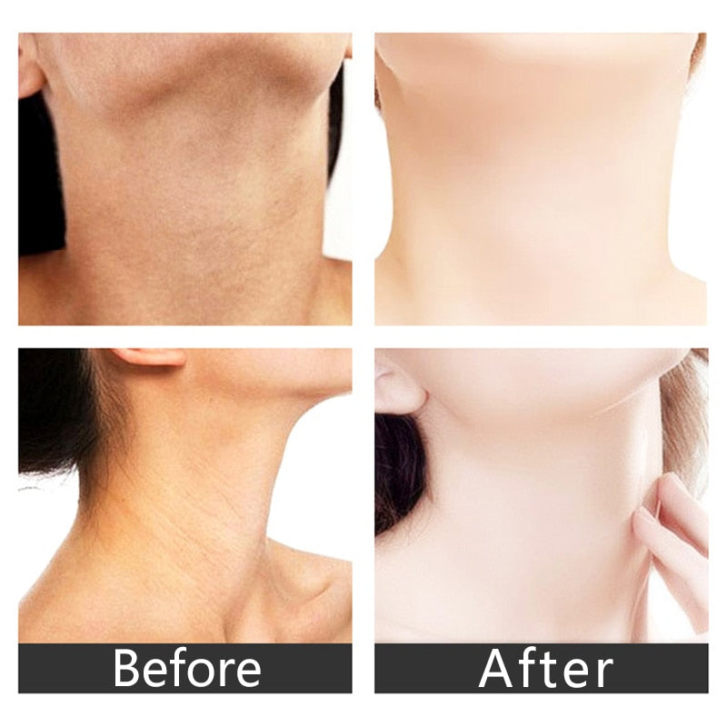 Neck Anti Wrinkle Face Lifting Device in pink and white, showcasing its sleek design and LED features for skin rejuvenation.