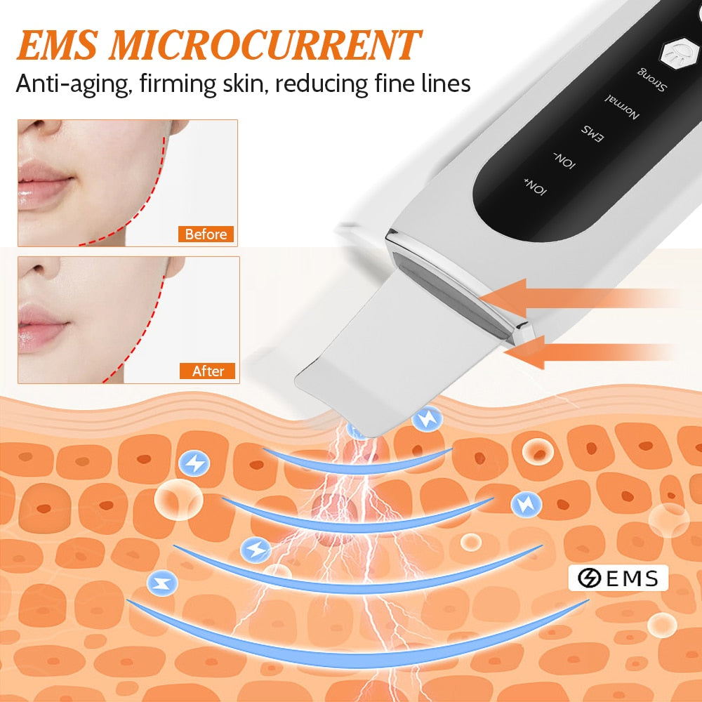 Ultrasonic Skin Scrubber EMS Microcurrent Face Lifting Machine in white, showcasing its sleek design and stainless steel head for effective skin treatment.