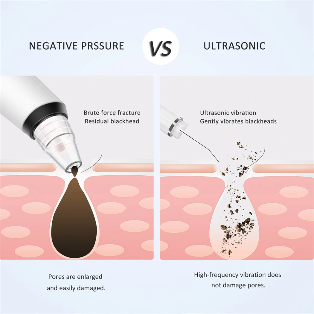 Ultrasonic Skin Scrubber with multiple modes for acne and blackhead removal, featuring a sleek design and a charging port.