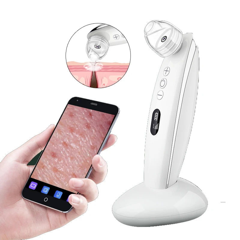 Visual Blackhead Vacuum Kit with HD camera and charging base, showcasing its sleek design and multiple probes for effective skincare.