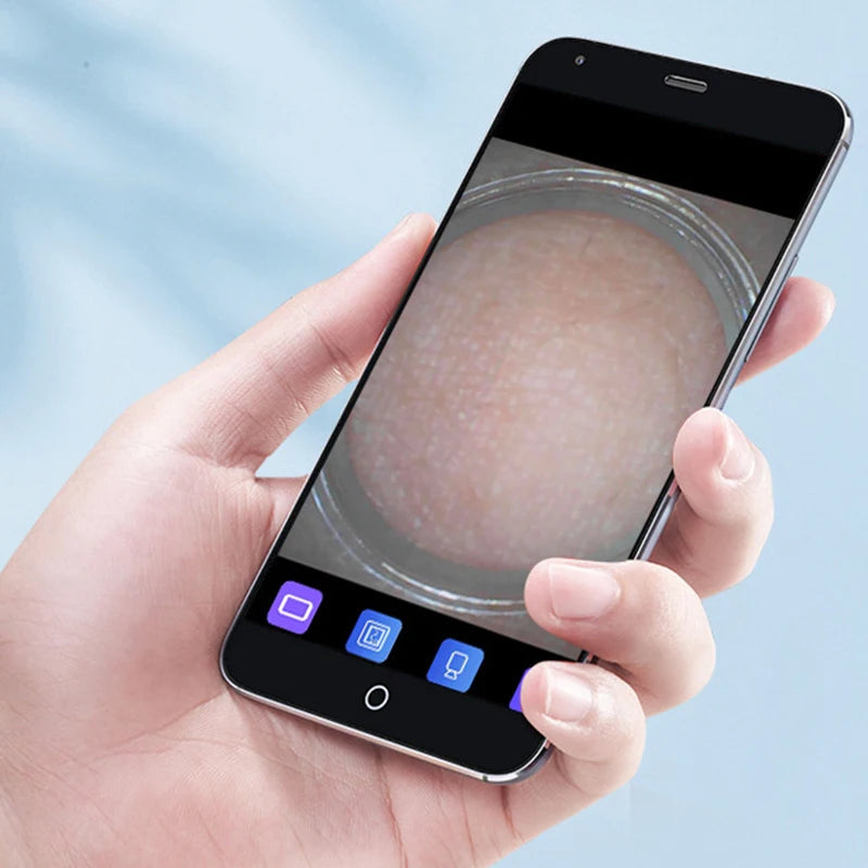 Visual Blackhead Vacuum Kit with HD camera and charging base, showcasing its sleek design and multiple probes for effective skincare.