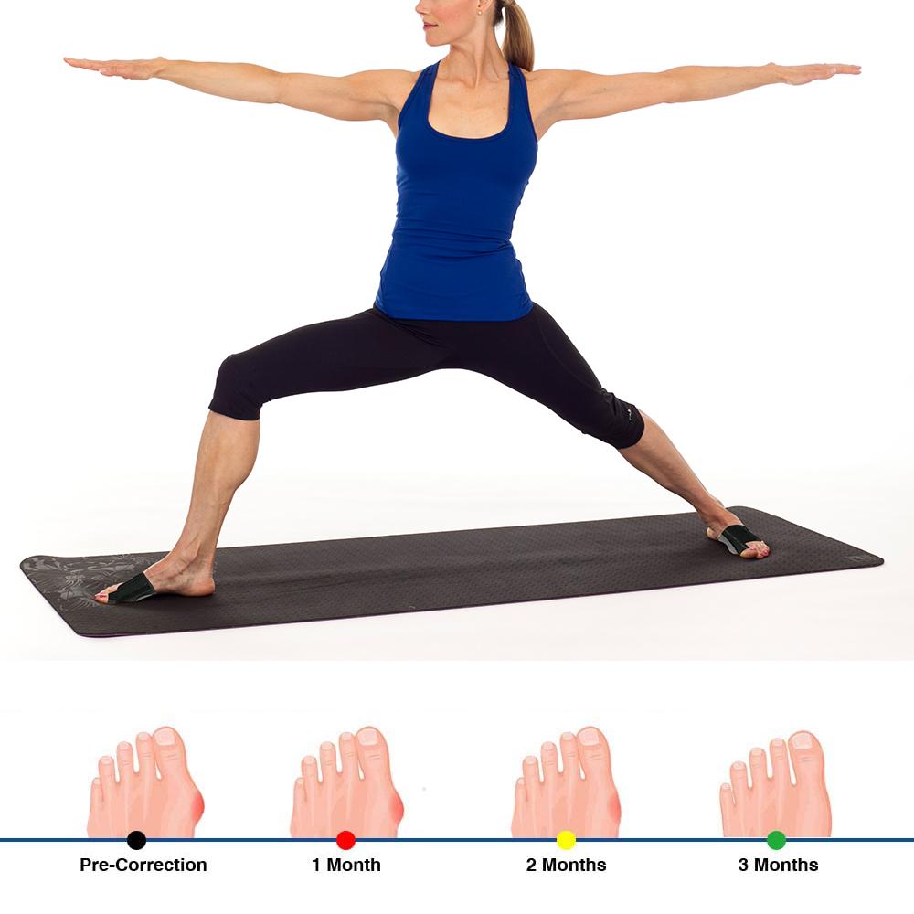 2pcs Soft Bunion Corrector Toe Separator Splint designed for foot care, featuring adjustable straps and soft materials for comfort.