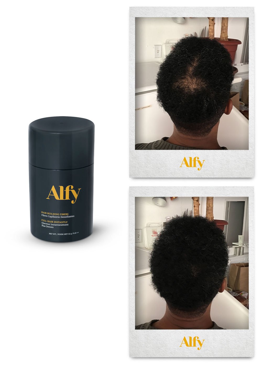 Alfy 12g Starter Kit featuring hair building fibers, fiber lock spray, and hairline optimizer for fuller hair.