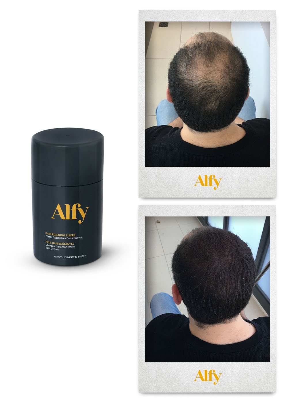 Alfy 12g Starter Kit featuring hair building fibers, fiber lock spray, and hairline optimizer for fuller hair.