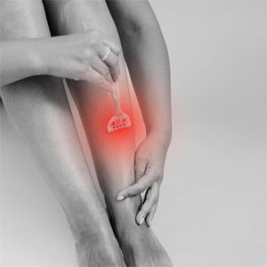 Eine Frau, die ein Gesichtsdampfbad mit Kräutern zur Behandlung von Akne und fettiger Haut anwendet.