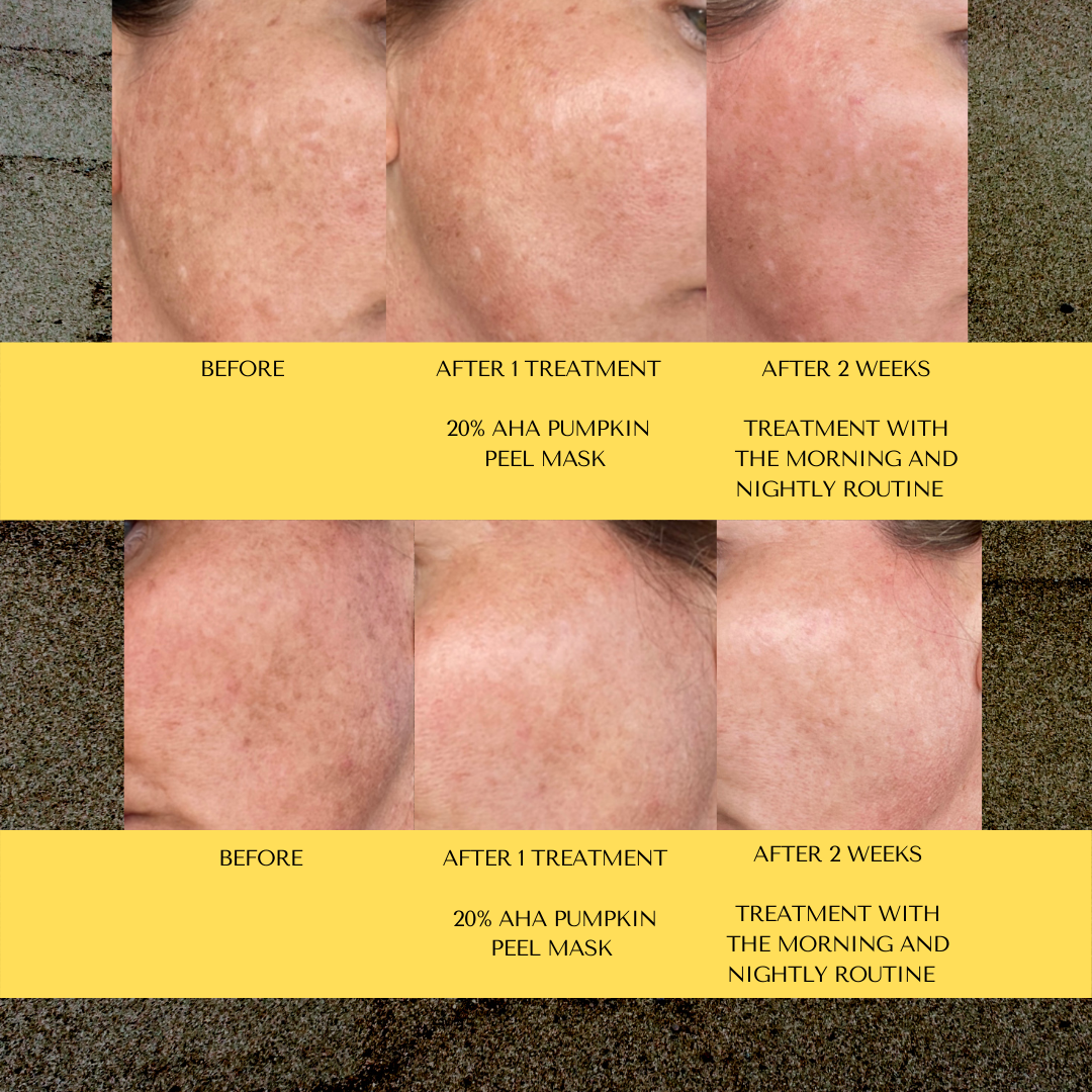 A bottle of Vitamin C Cleanser for normal to combination skin, designed to reduce sun spots and age spots.