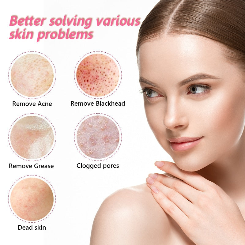 Facial Blackhead Remover Electric Acne Cleaner Device in pink and green with interchangeable suction heads and USB charging cable.