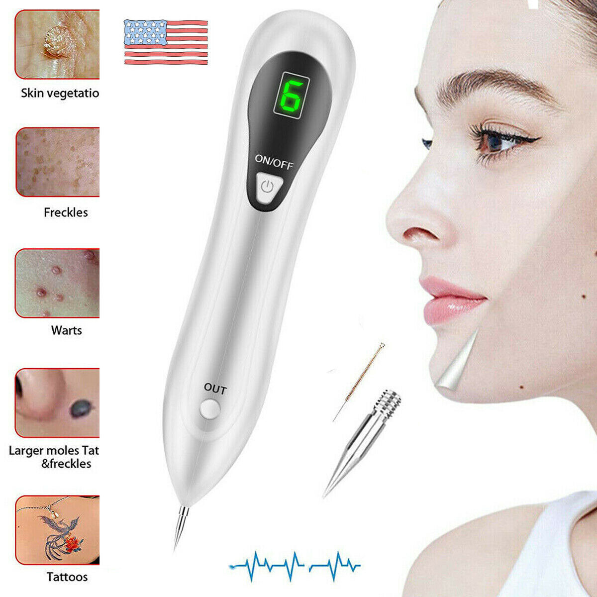 Electric Laser Plasma Pen for mole and dark spot removal, featuring a sleek white design and ergonomic shape for easy handling.