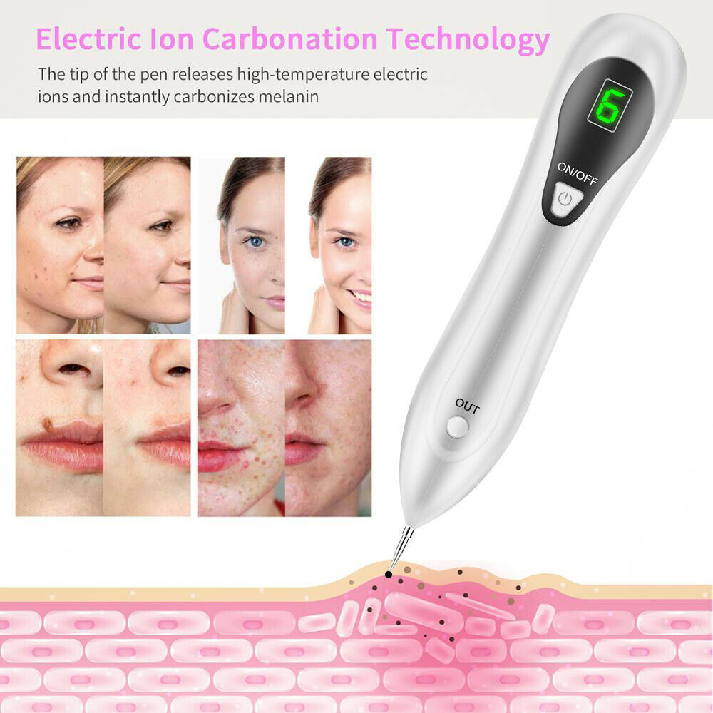 Electric Laser Plasma Pen for mole and dark spot removal, featuring a sleek white design and ergonomic shape for easy handling.