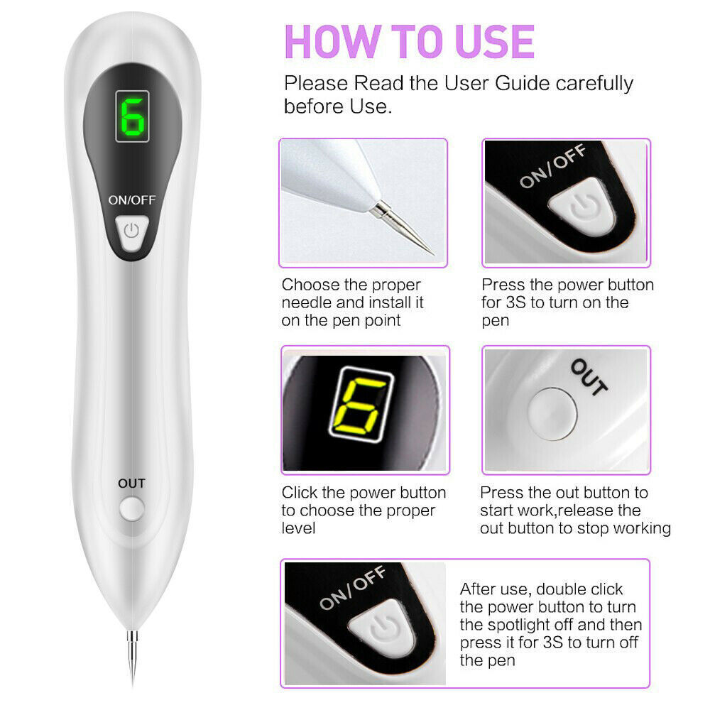 Electric Laser Plasma Pen for mole and dark spot removal, featuring a sleek white design and ergonomic shape for easy handling.
