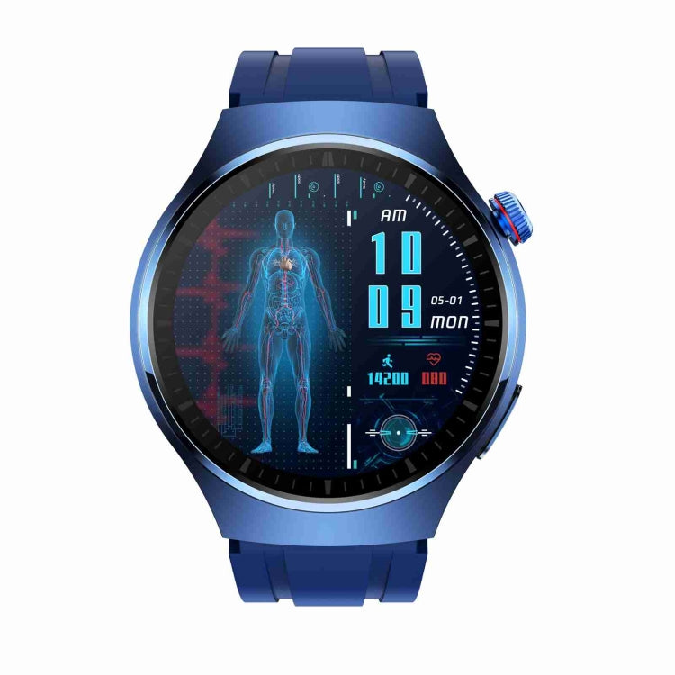 MT200 1.43 inch AMOLED IP67 Smart Call Watch showcasing its sleek design and advanced health monitoring features.